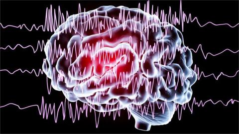 علاج كهرباء المخ البسيطة طبيعياً بالقرآن
