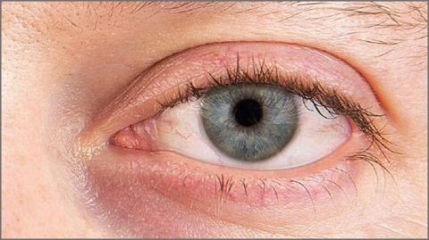 عوائم العين: ما هي وكيفية علاجها